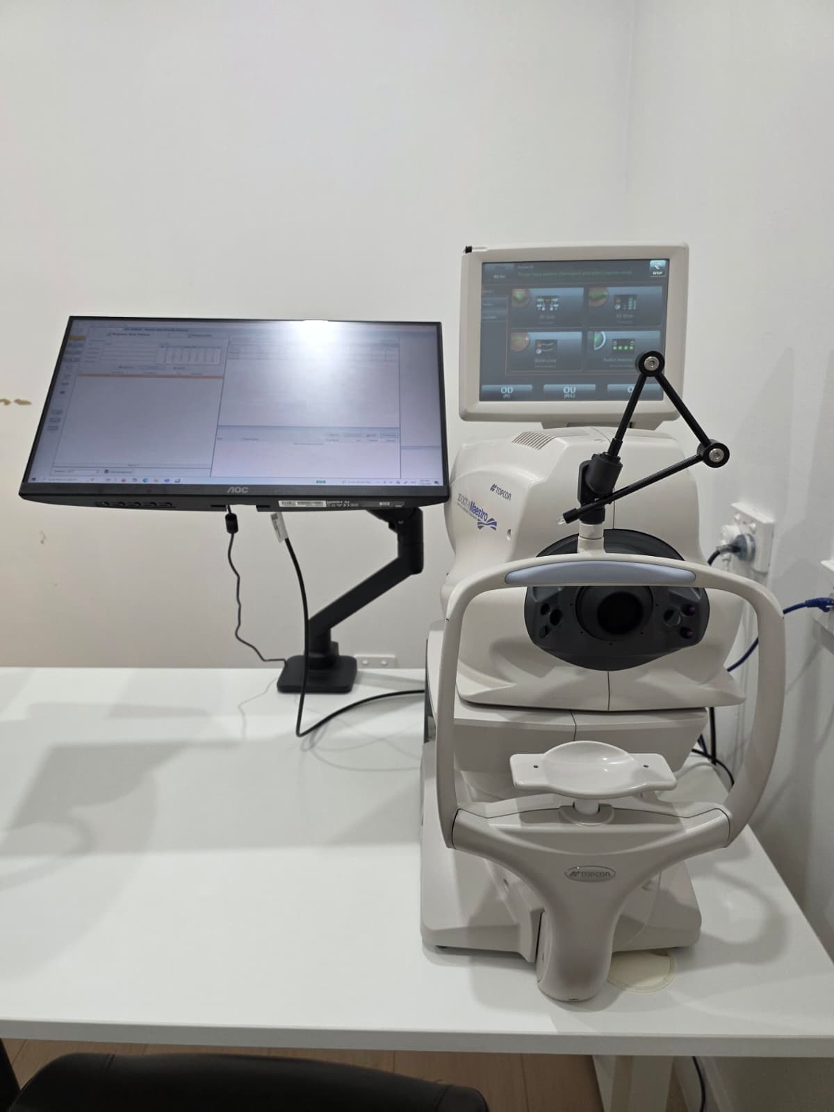 OCT imaging for dry eye assessment at Prime Optometrists Auburn